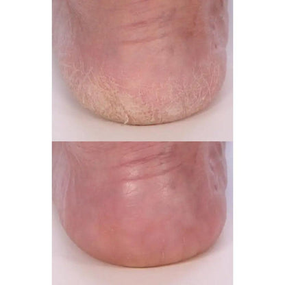 קרם רגליים טיפולי ™GreenAid - אכילאה, הדס ועץ התה | לבידו - Lavido - פריקפוא
